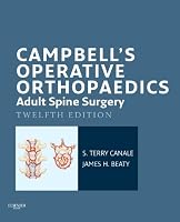 Campbell's Operative Orthopaedics (6 book series) Kindle Edition